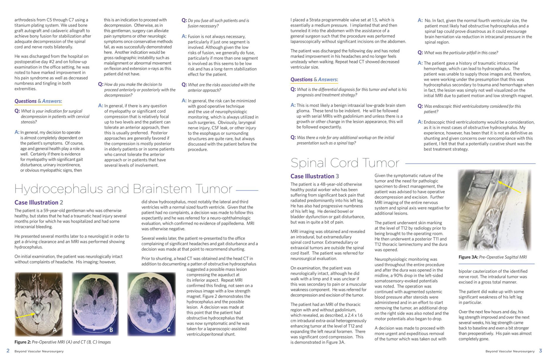 NSPC Newsletter Beyond Vascular Surgery Spring 2021 page 2